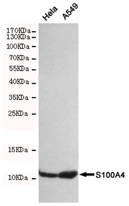 WB - Anti-S100A4 Antibody AP53395